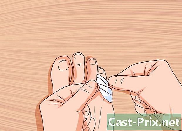 Како третирати сломљени мали ножни прст