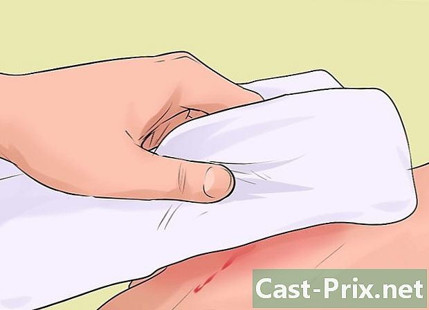 ابتدائی طبی امداد کے دوران شدید خون بہنے کا علاج کیسے کریں