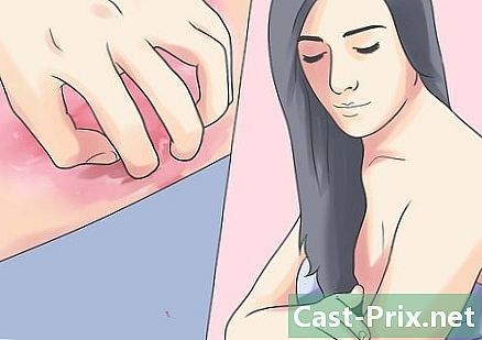 Como tratar a inflamação da pele