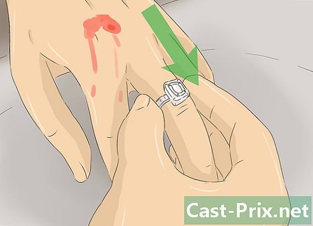 ガラガラヘビ咬傷の治療方法