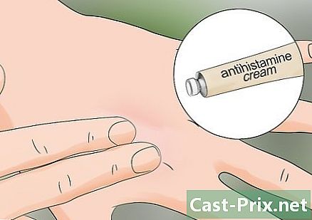Com tractar una picada d’eruga - Guies