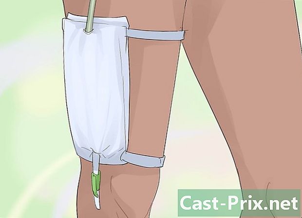 Как да изпразните торба с урина