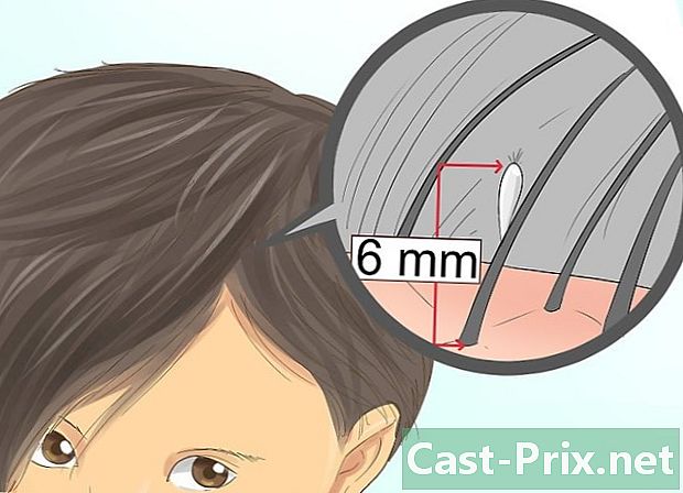 Cách kiểm tra chấy trên tóc trẻ em - HướNg DẫN